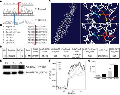 Case Report: Novel STIM1 Gain-of-Function Mutation in a Patient With TAM/STRMK and Immunological Involvement